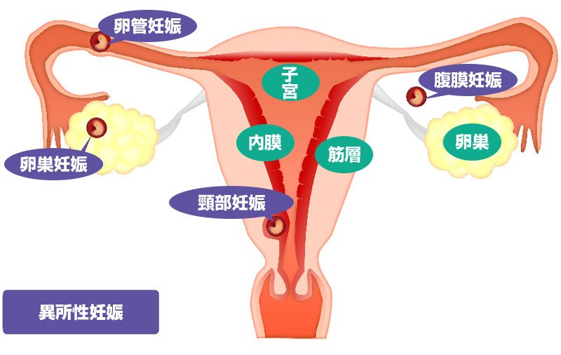 卵巣刺激法の種類