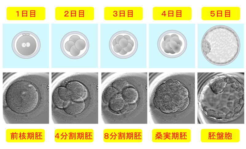 顕微授精のための裸化処理