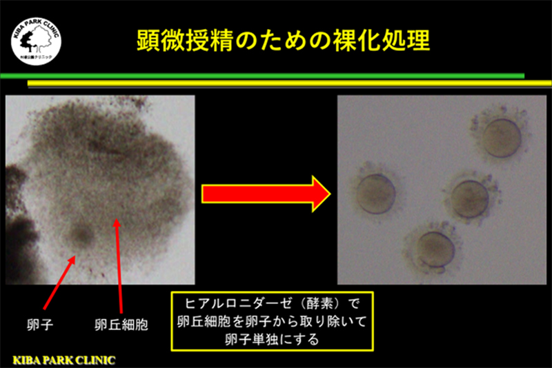 顕微授精のための裸化処理