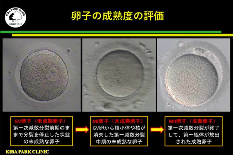 卵子の成熟の評価