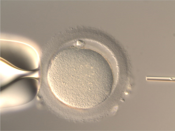 精子を卵子に注入する