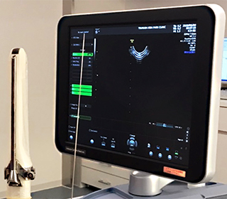 超音波断層装置、経腟プローブ、採卵針