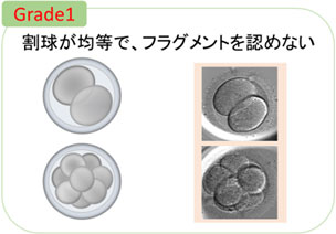 Grade1 割球が均等、フラグメントを認めない