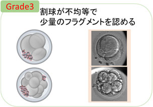 Grade3 割球が不均等で、少量フラグメントを認める