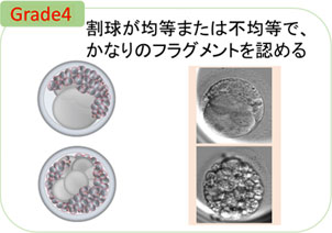 Grade4 割球が均等または不均等で、かなりのフラグメントを認める