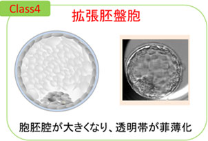 拡張胚盤胞