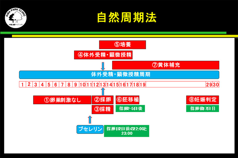 自然周期法