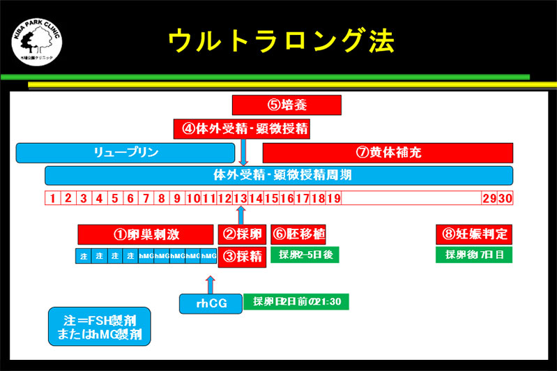 ウルトラロング法