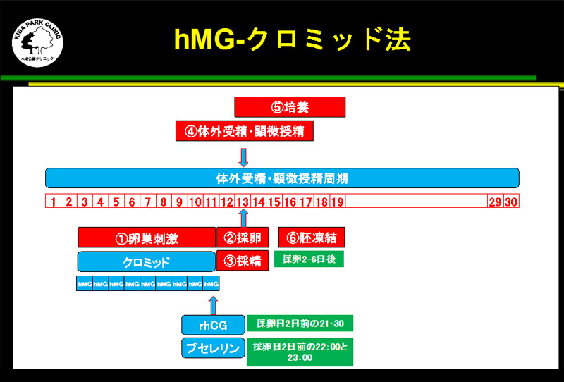 hMGクロミッド法