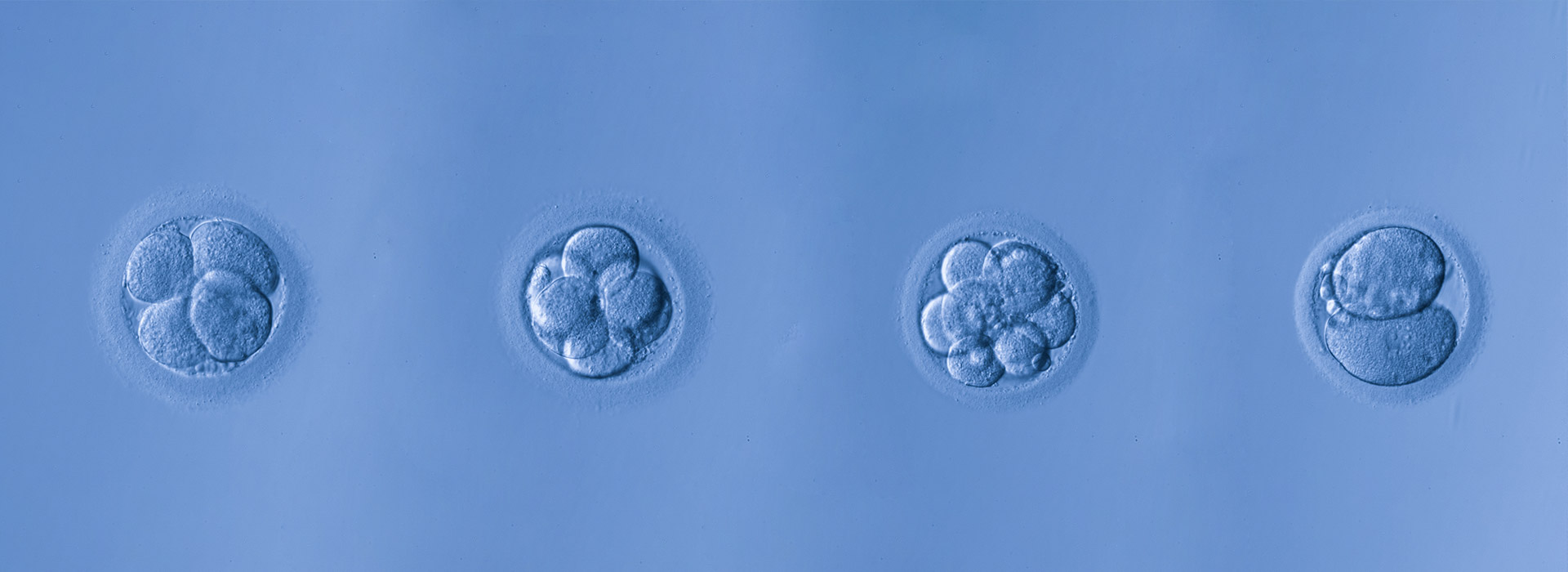 受精卵 胚 胚盤胞 のグレードについて 評価のポイントを解説 木場公園クリニック