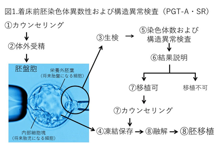 着床前胚染色体異数性および構造異常検査（PGT-A・SR）